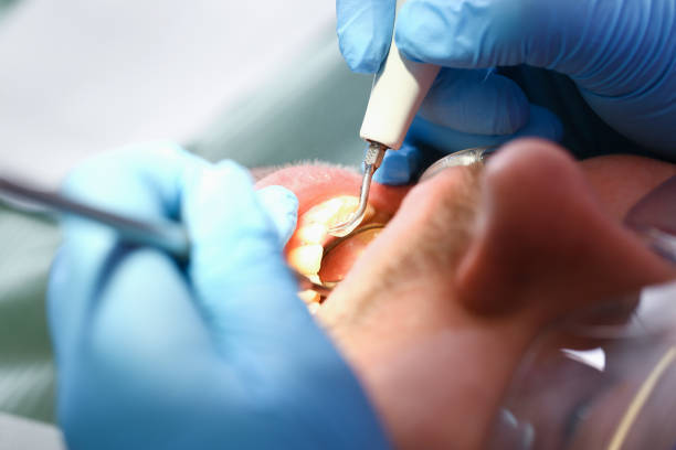 Best After-Hours Emergency Dentist in Humble, TX