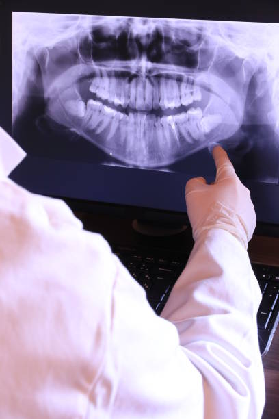 Best Emergency Wisdom Teeth Removal in Humble, TX