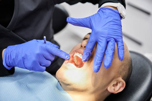 Best Emergency Broken Tooth Repair in Humble, TX