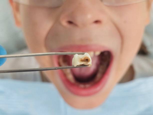 Best Same-Day Emergency Dentist in Humble, TX